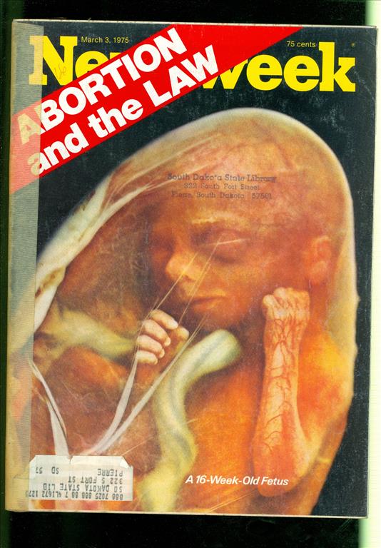 abortion how protect the embryo Pro-abortion pro-abortion - definition pro-abortion is the belief in the right to choose to terminate a fetus (fertilized embryo) pro-abortion is also a movement, which fights for the rights of women to have a choice to end unwanted pregnancies. abortion how protect the embryo Pro-abortion pro-abortion - definition pro-abortion is the belief in the right to choose to terminate a fetus (fertilized embryo) pro-abortion is also a movement, which fights for the rights of women to have a choice to end unwanted pregnancies.